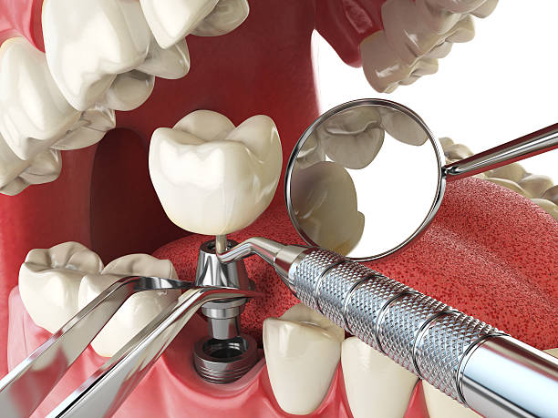 Best Emergency Dental Surgery in Glens Falls North, NY